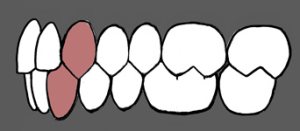 Normalan zagrižaj i raspored zuba